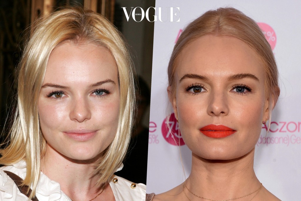 같은 얼굴, 심지어 10년 전 얼굴임에도 불구하고 지금이 훨씬 어려 보이는 이유?! Kate Bosworth 